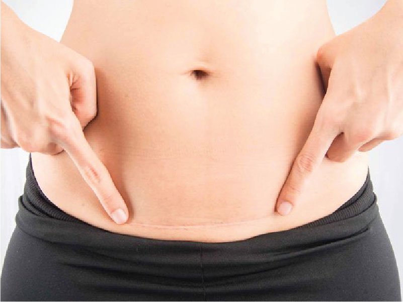 Phụ nữ mang thai, đặc biệt là trong 3 tháng đầu thai kỳ, có chống chỉ định với thuốc tẩy giun Fugacar